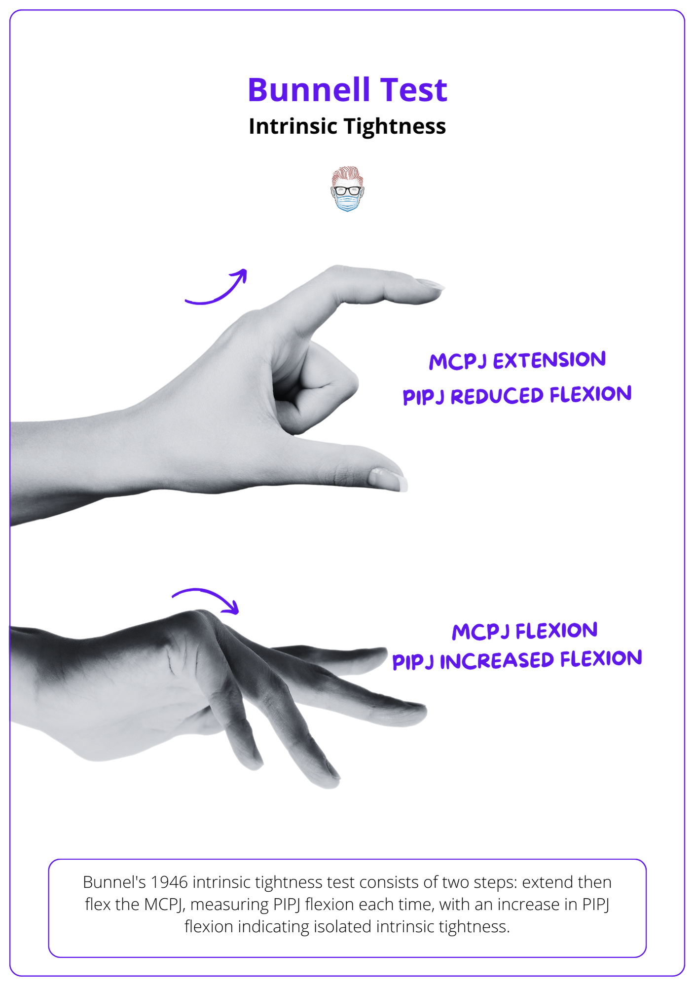 intrinsic plus deformity