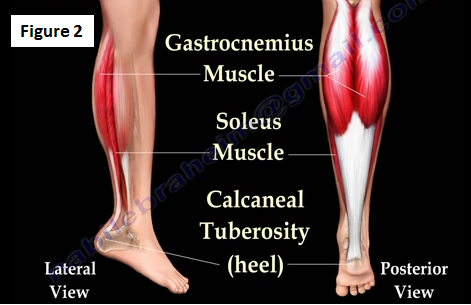 gastrocnemius tear icd 10