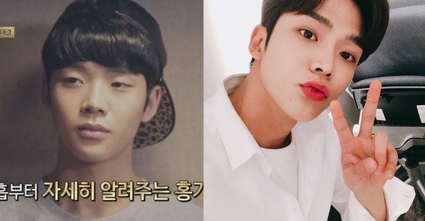 rowoon plastic surgery