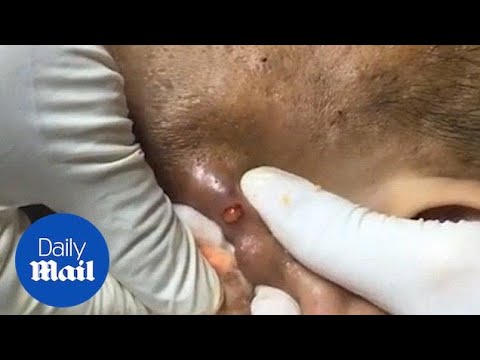 zit pop video