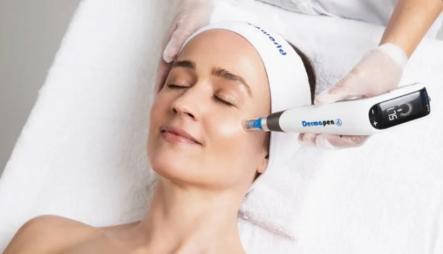 microneedling hobart