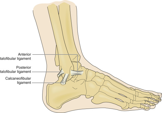 sprain of ankle icd 10