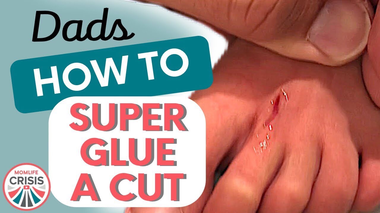 krazy glue for cuts