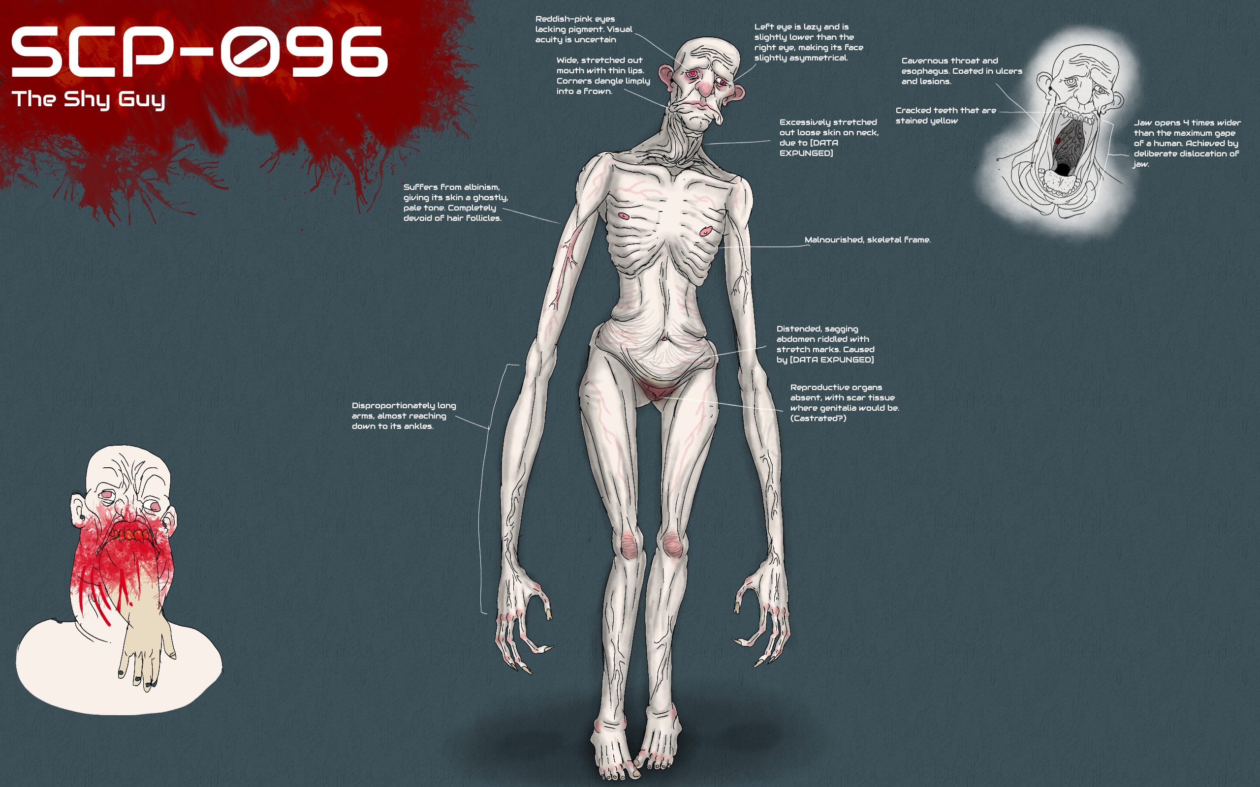 scp 096 bones