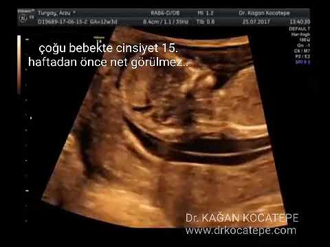 erkek bebek ultrasonda nasil durur