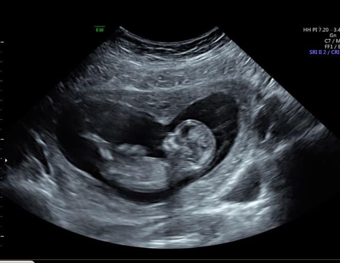 southcoast womens ultrasound