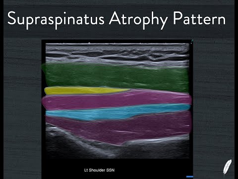 stephen bird ultrasound