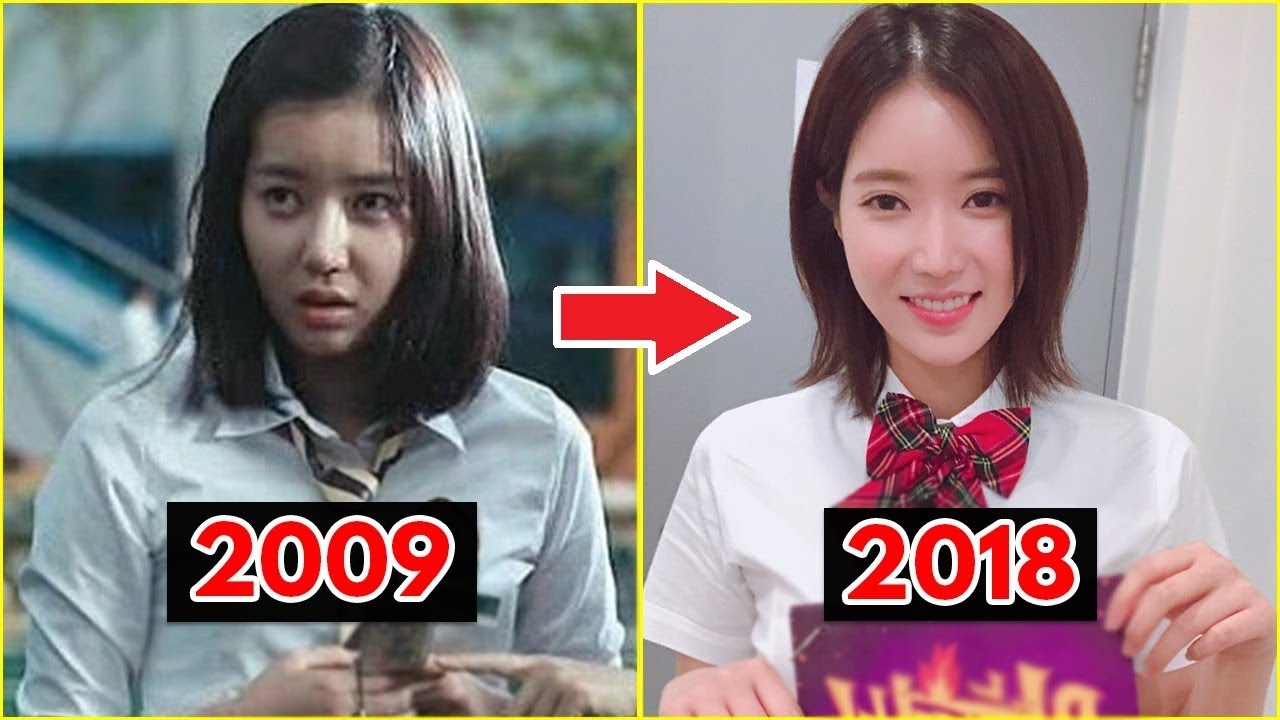 did im soo hyang have plastic surgery