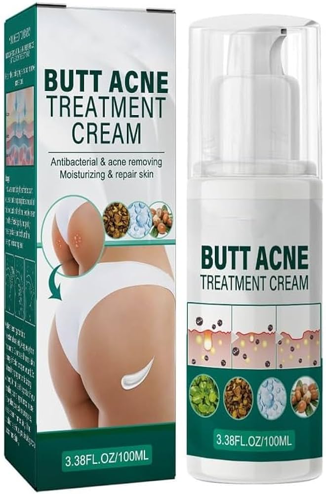 butt acne cream