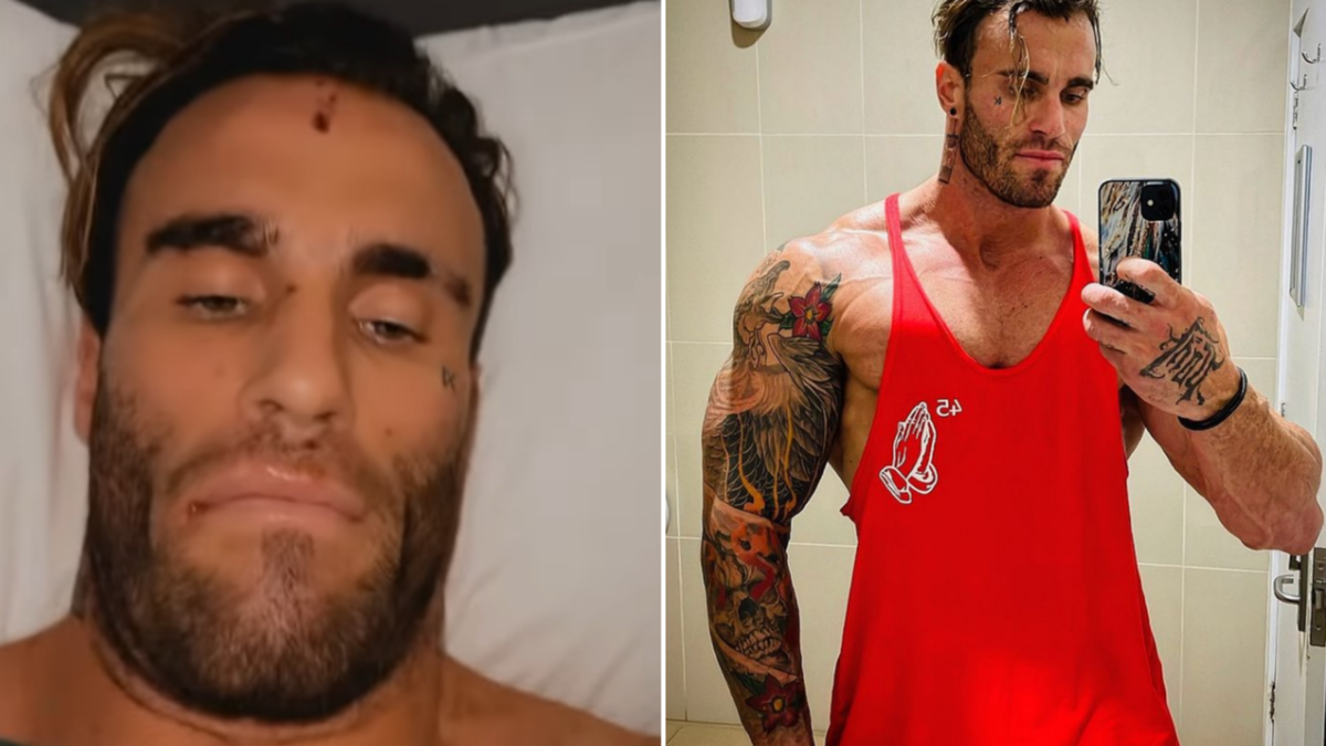 calum von moger injury