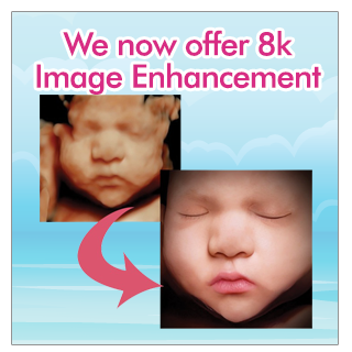 3d sonogram dallas