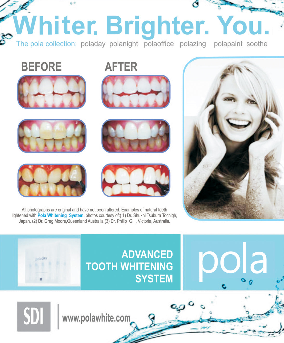 polanight teeth whitening reviews