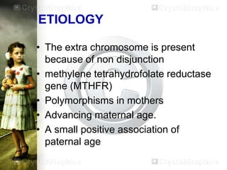 edward syndrome ppt