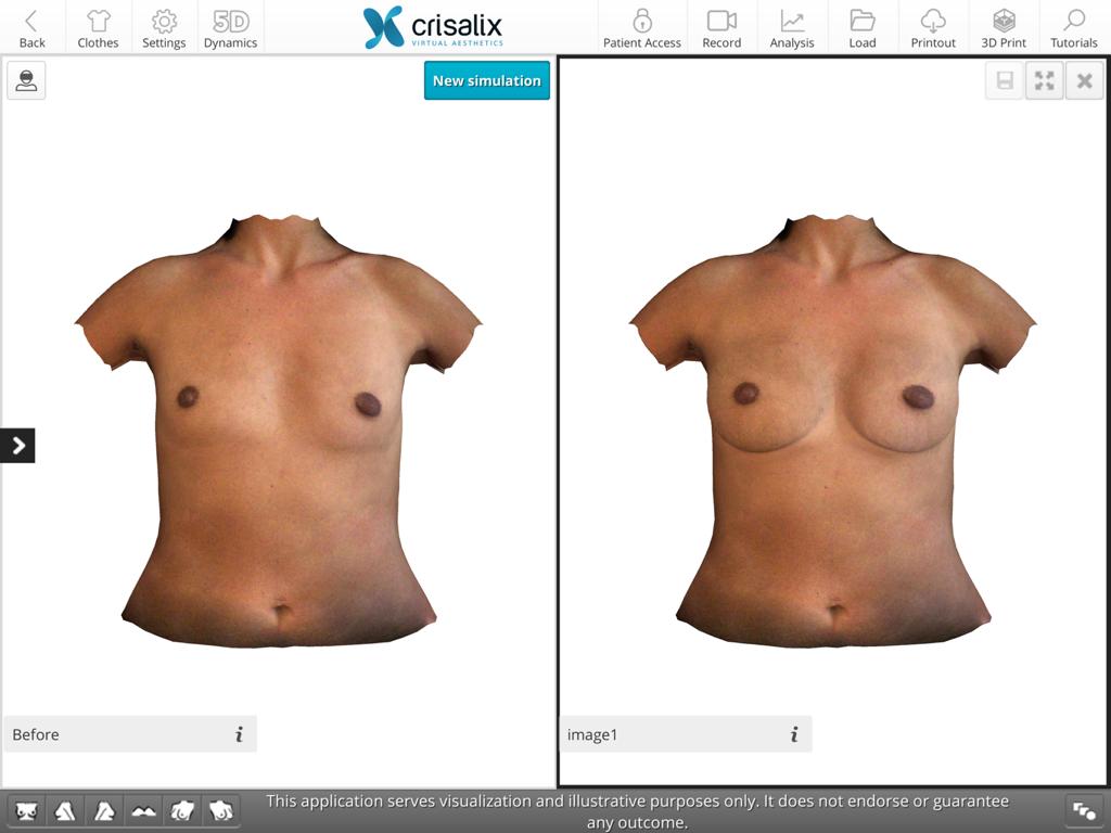 breast expansion simulator