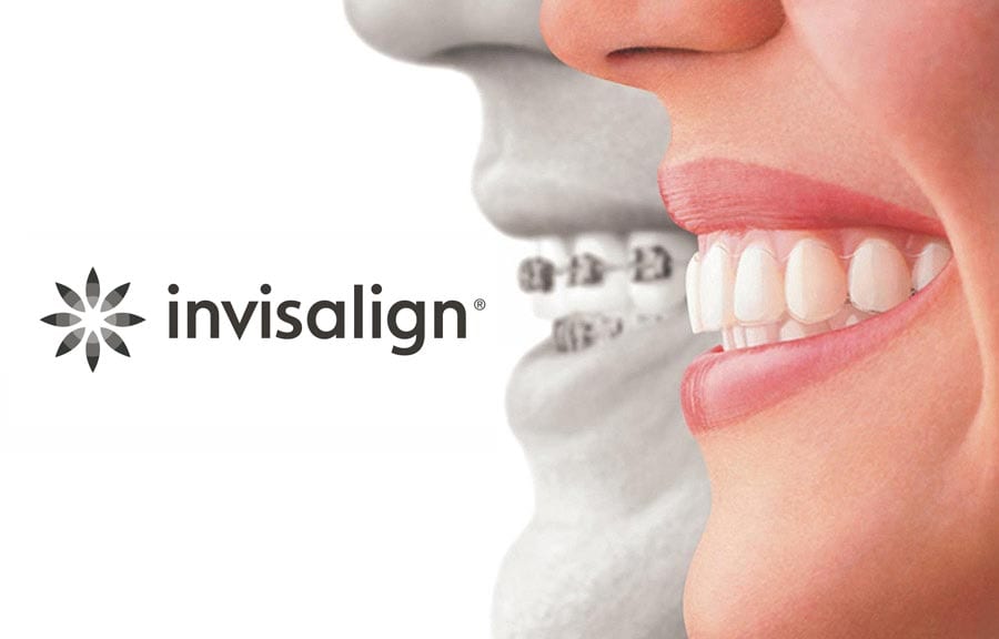 invisalign doctor site login