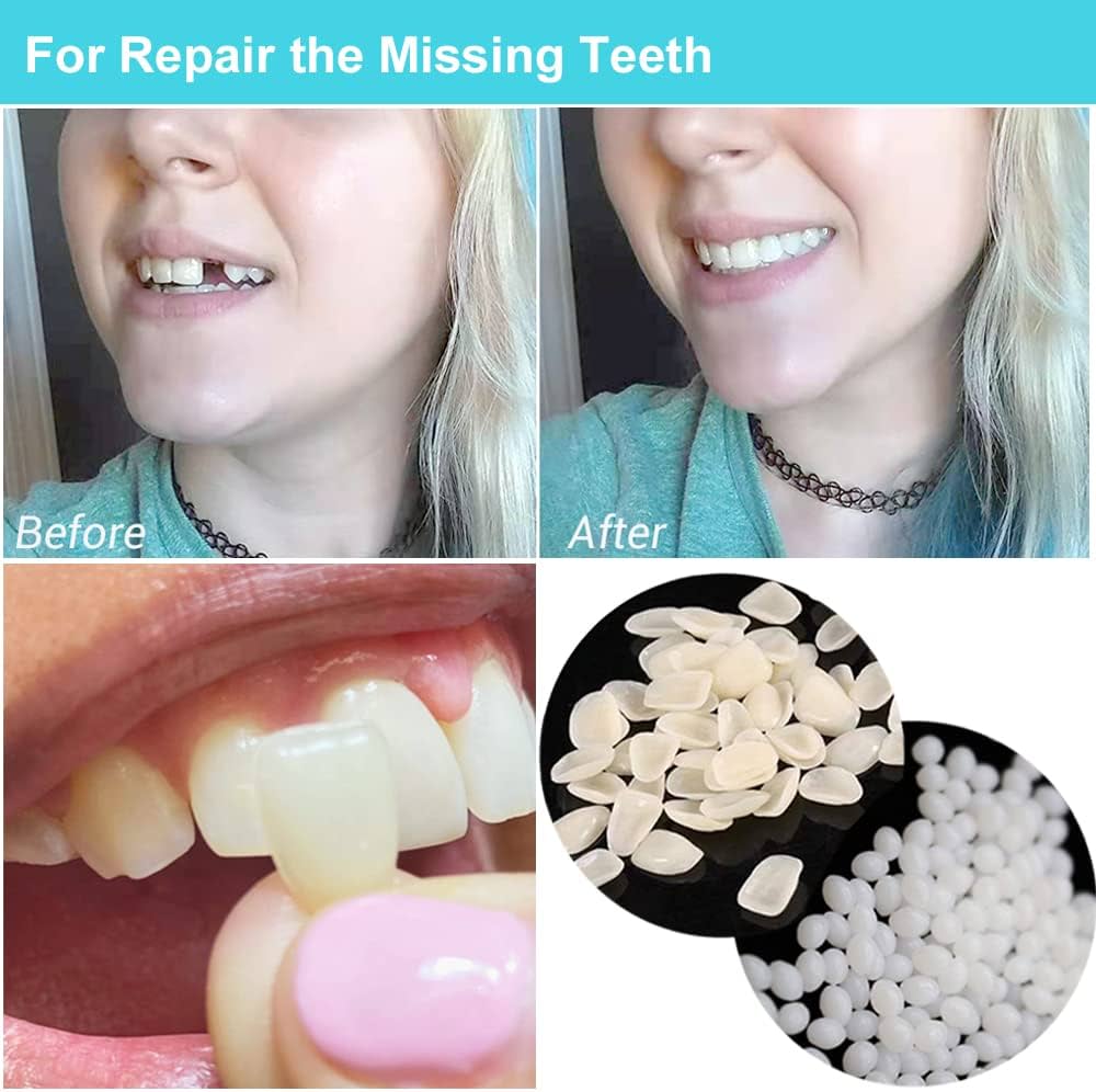 cracked tooth repair kit