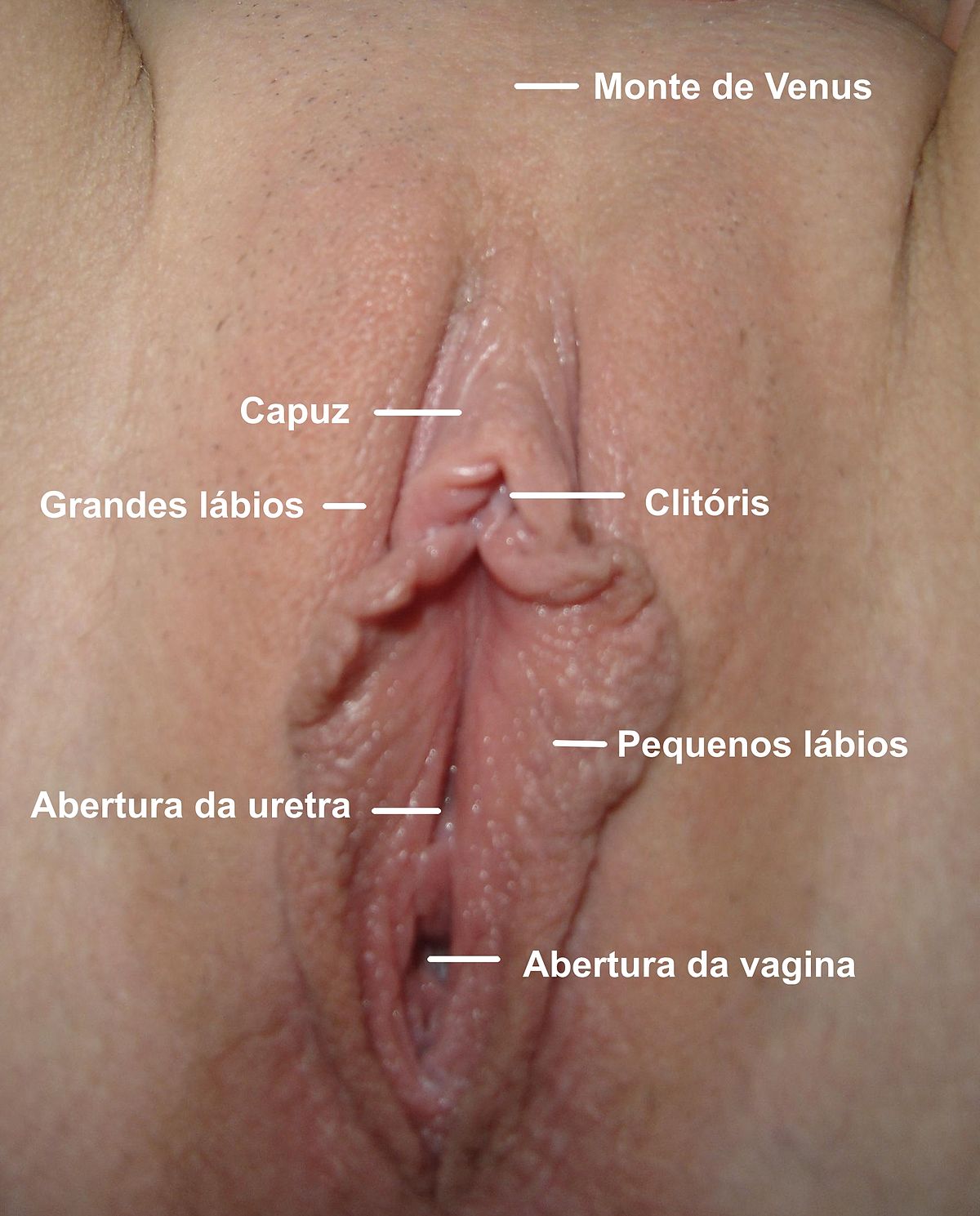 clitoris grande