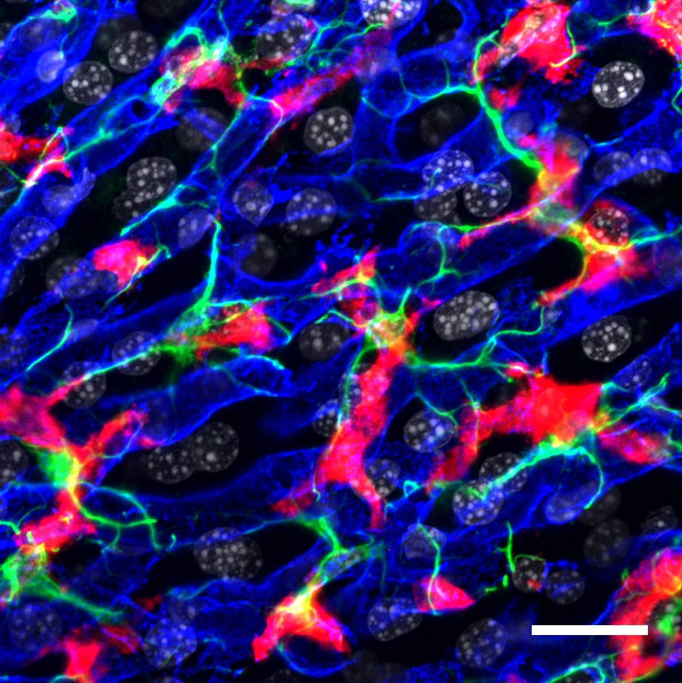 kupfer cells