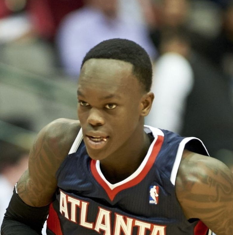 dennis schroder hairline