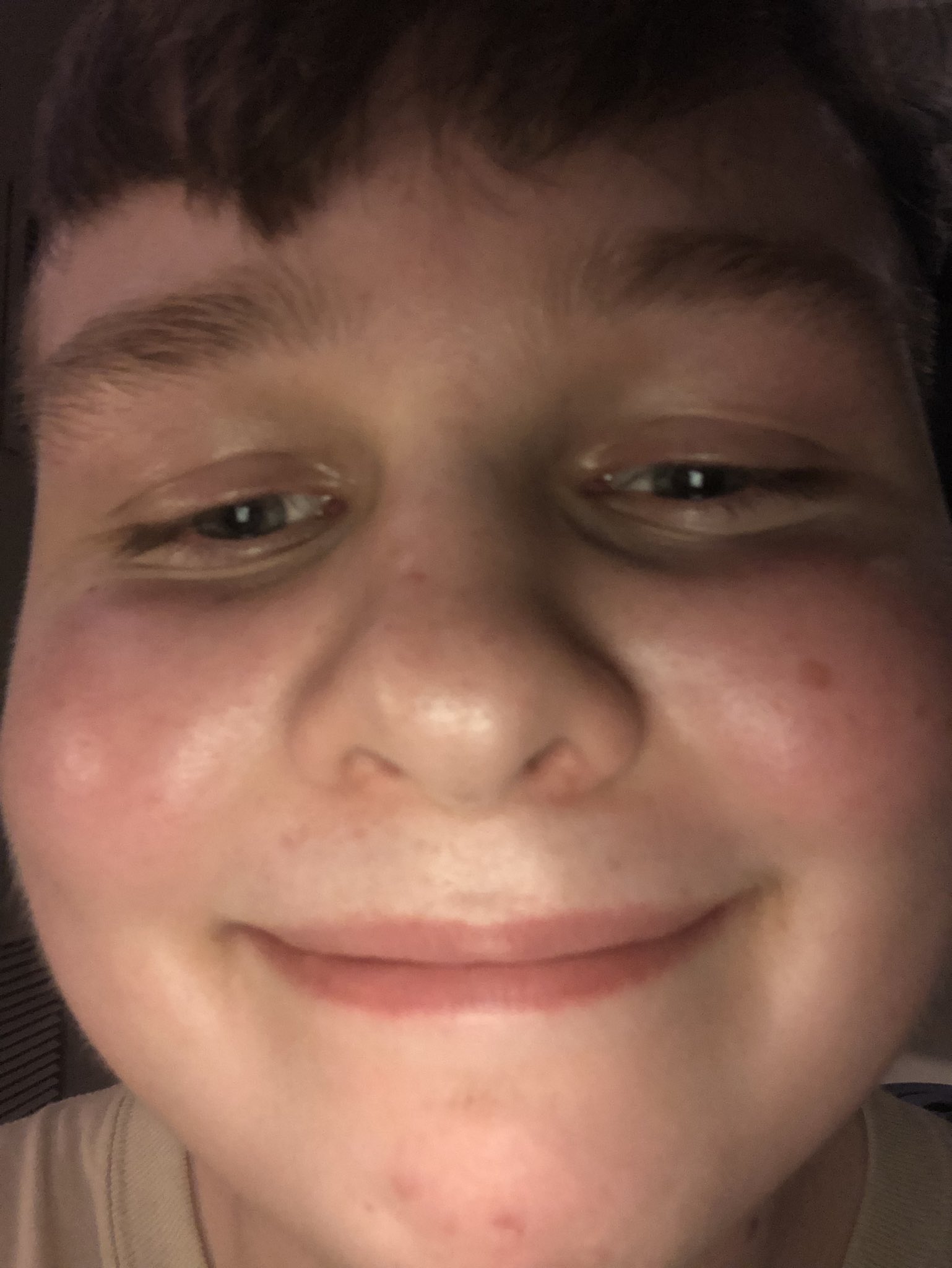 benjyfishy face