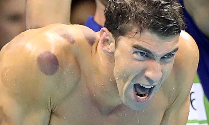 michael phelps cupping pictures