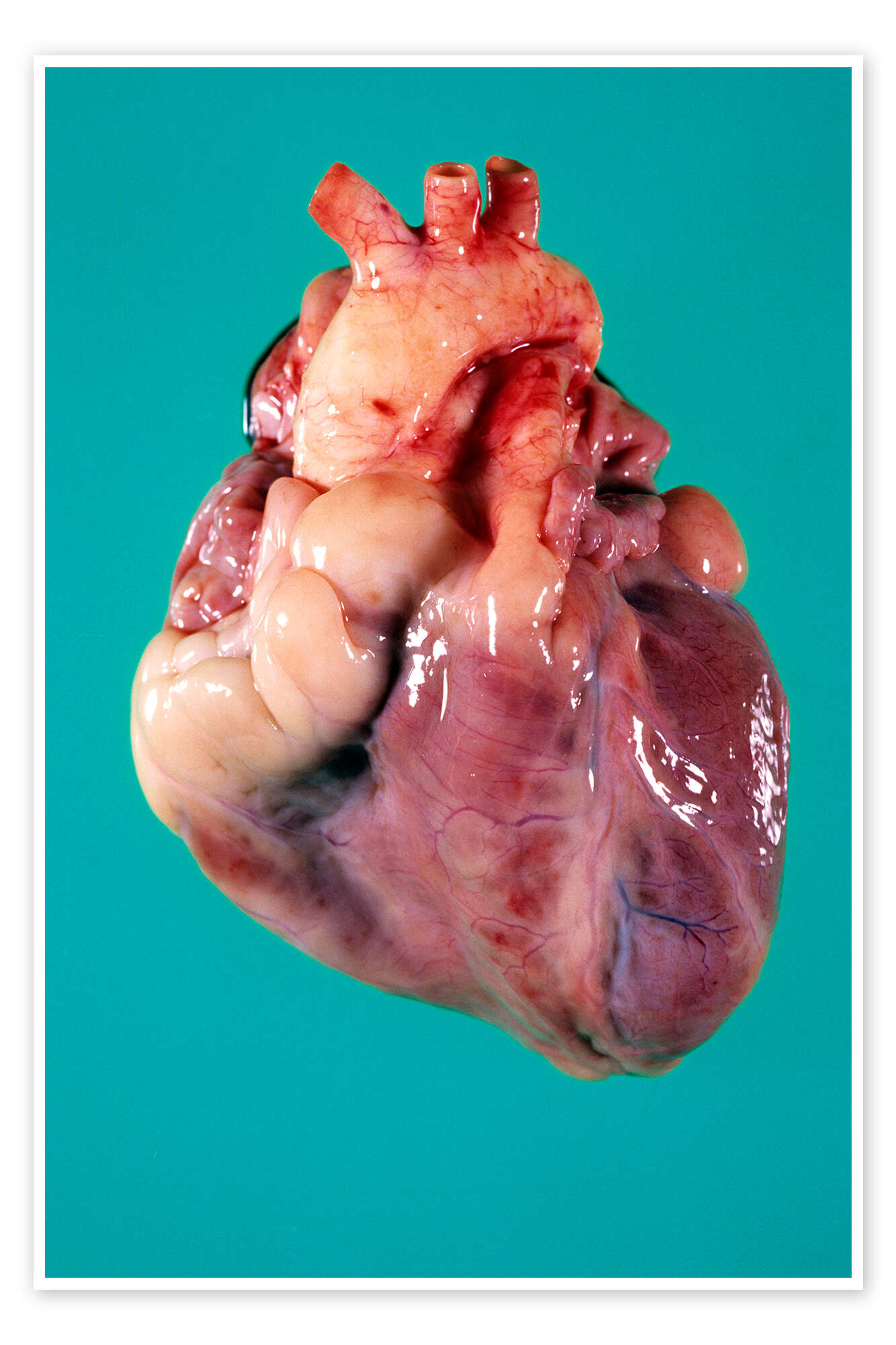 human heart pics images