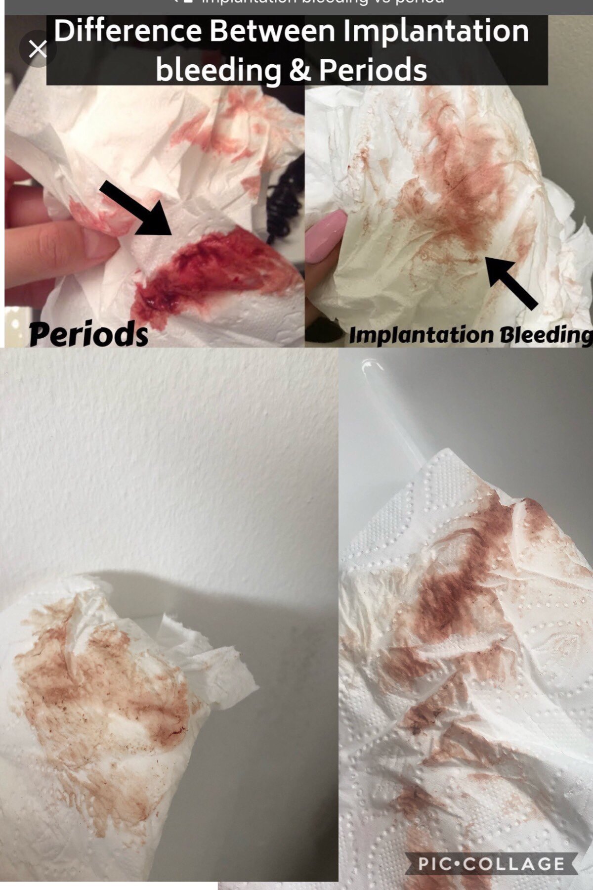 implantation bleeding photos