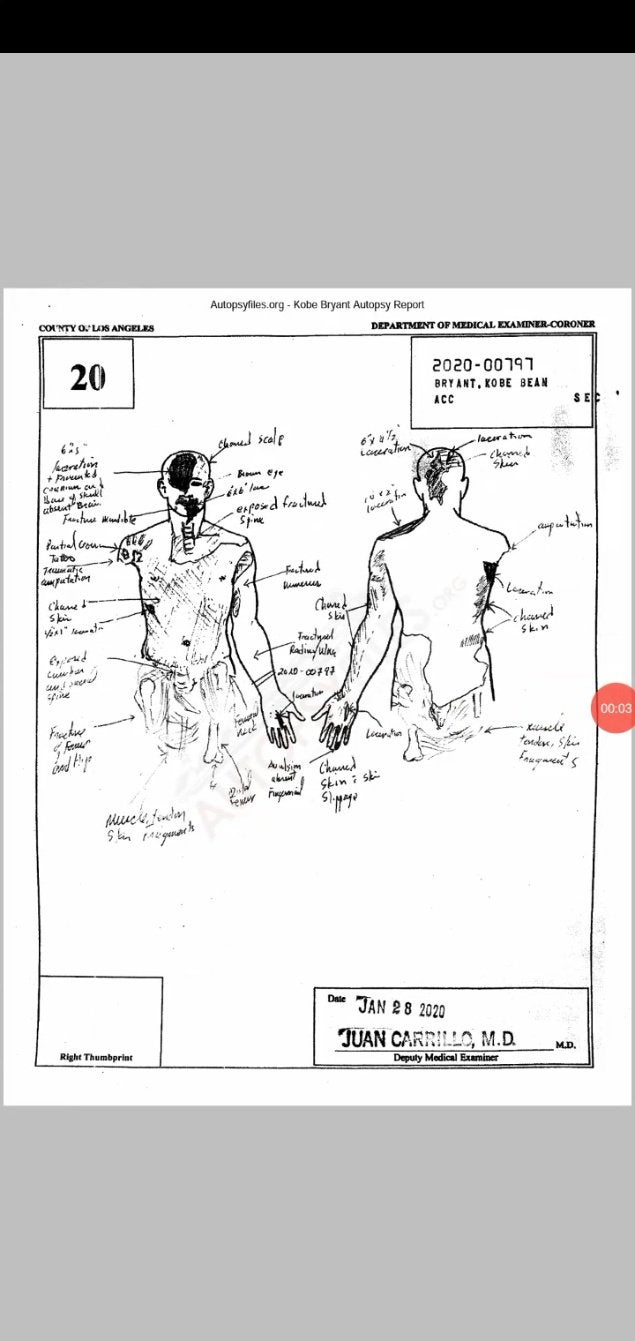 john altobelli autopsy report