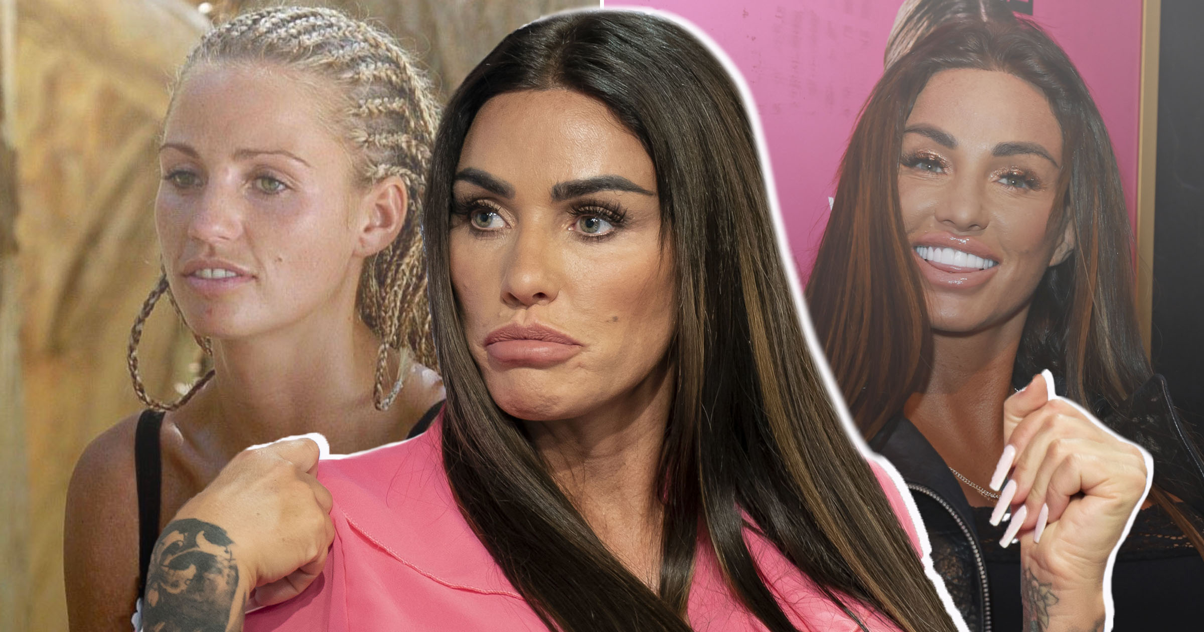 katie price face surgery