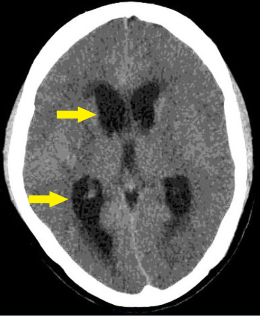 ncct medical abbreviation