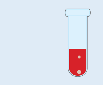 sickle cell screening test labcorp