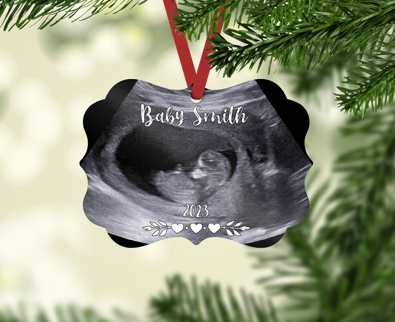 ultrasound ornament