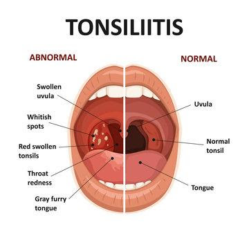 uvula meaning in tamil